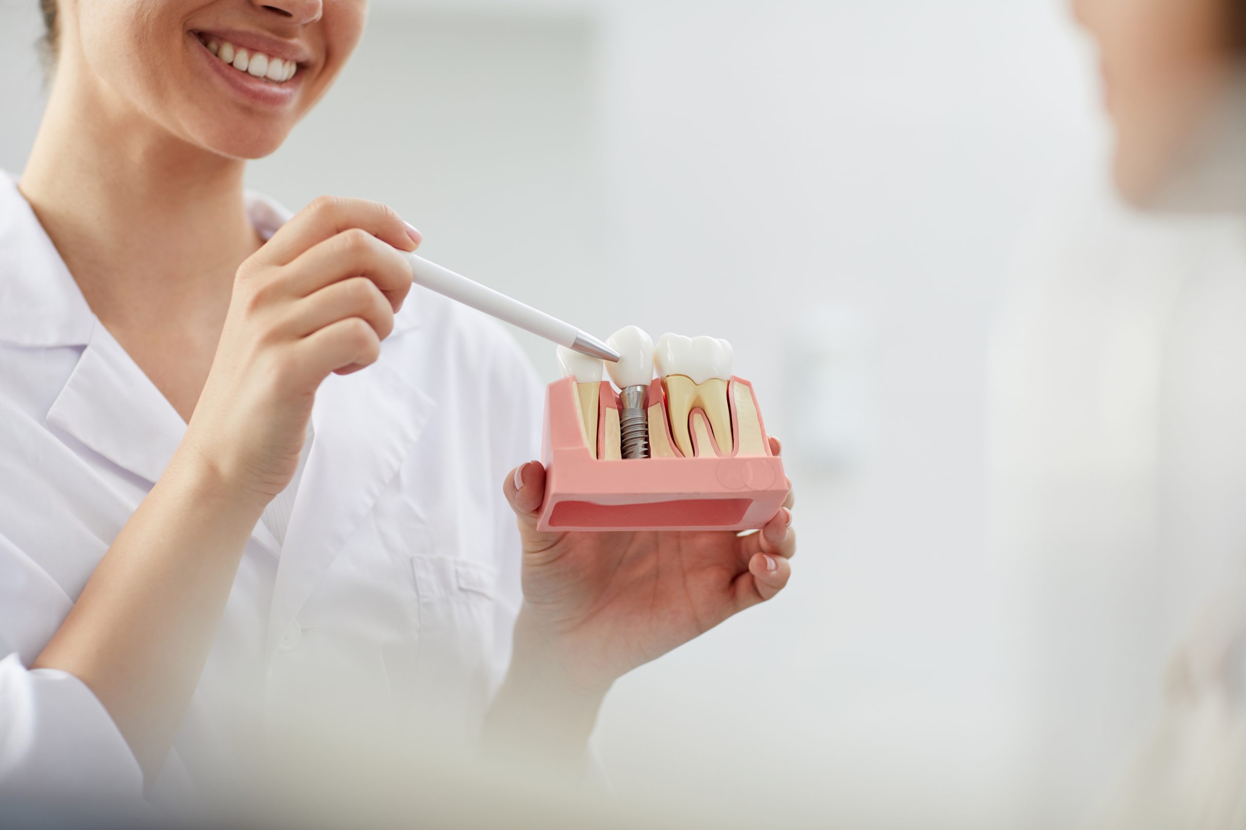 Implantes dentales en la clínica de Valdebebas