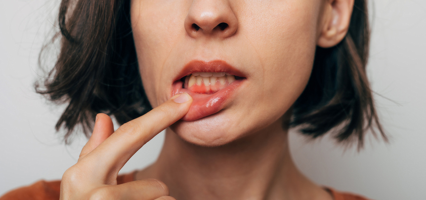 Enfermedades periodontales en Valdebebas